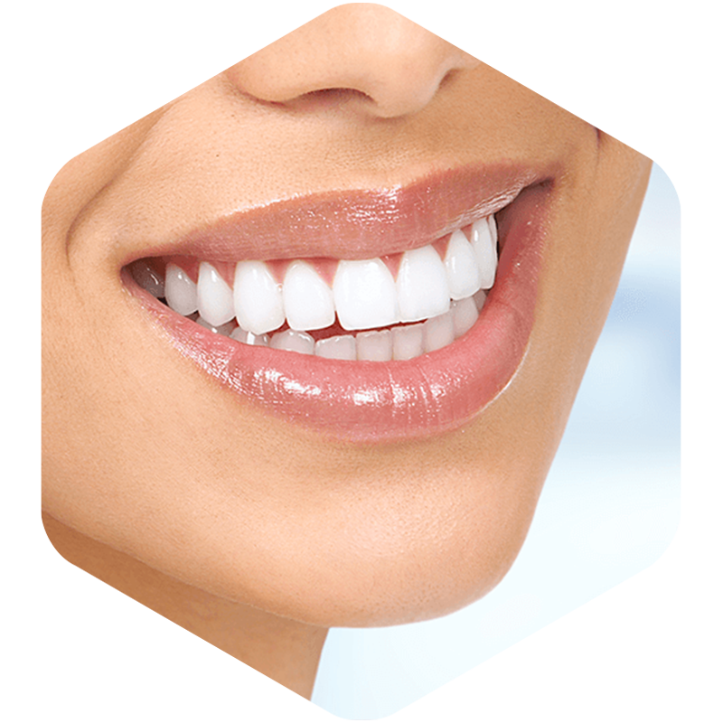 Patient with white teeth